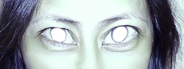 alien eye Fotomontaggio